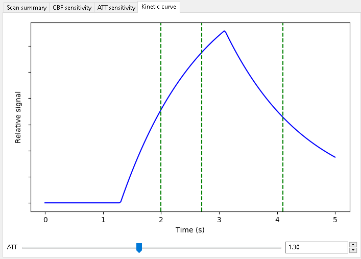 Kinetic curve for scan optimized for ATT and CBF