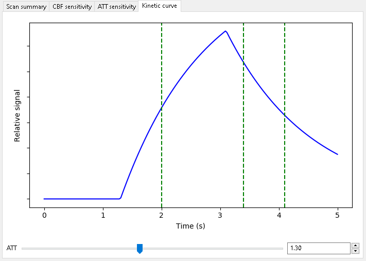 Kinetic curve for scan optimized for CBF